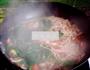 菠菜肉丝面的做法图解9