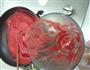 山楂酱的做法图解2