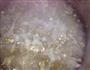 绿豆银耳薏仁汤的做法图解4